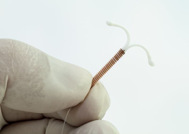 مزایا و معایب IUD